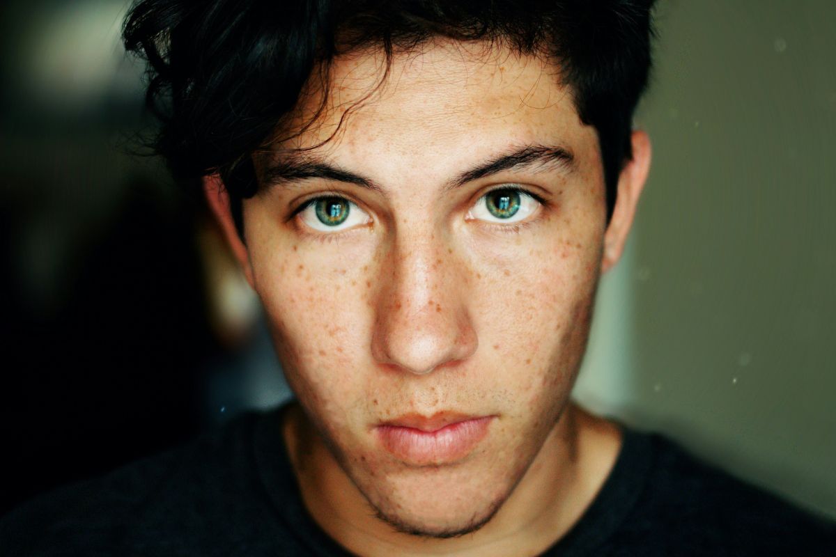 orang yang memiliki flek hitam di wajah